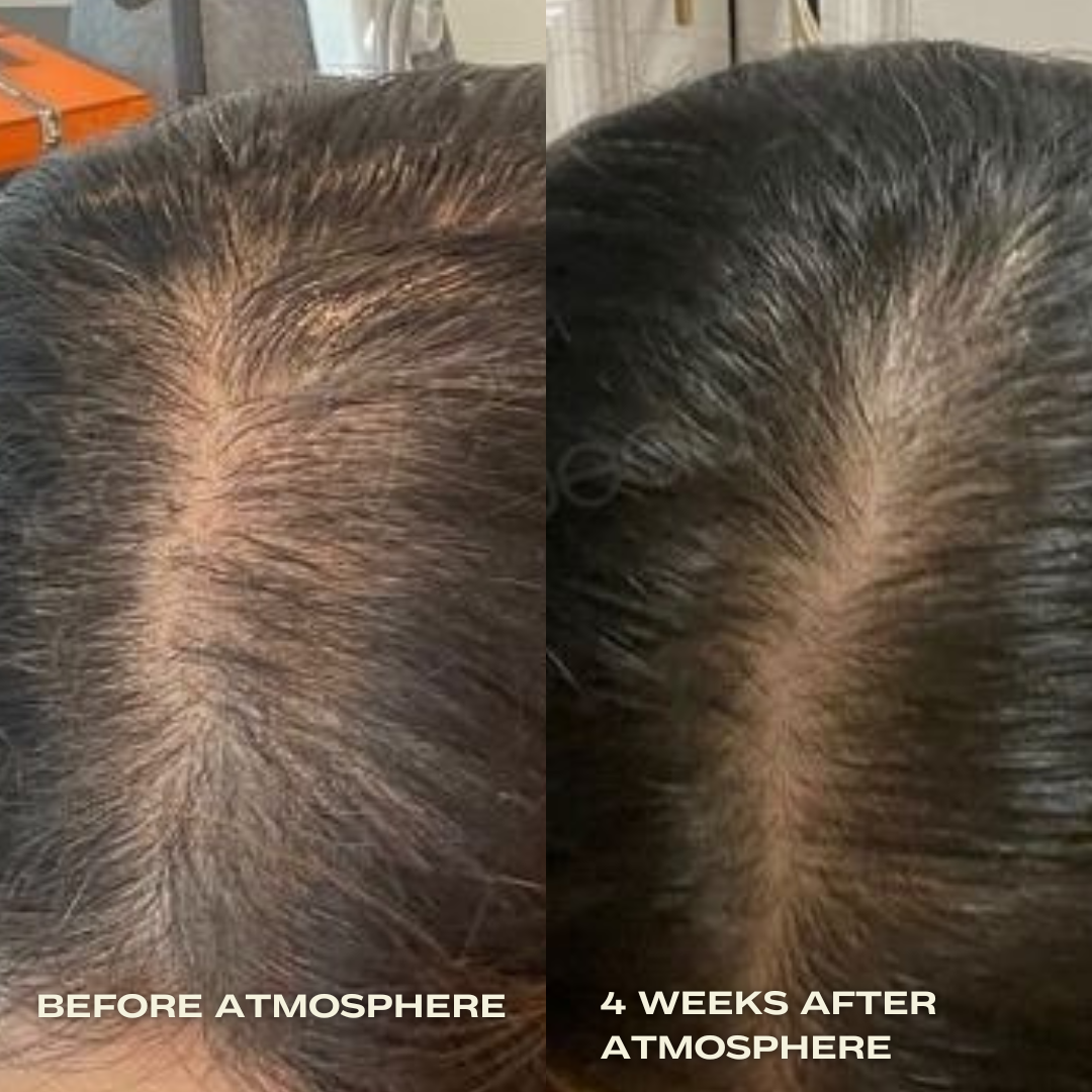Aphrodite Hair Density Kit