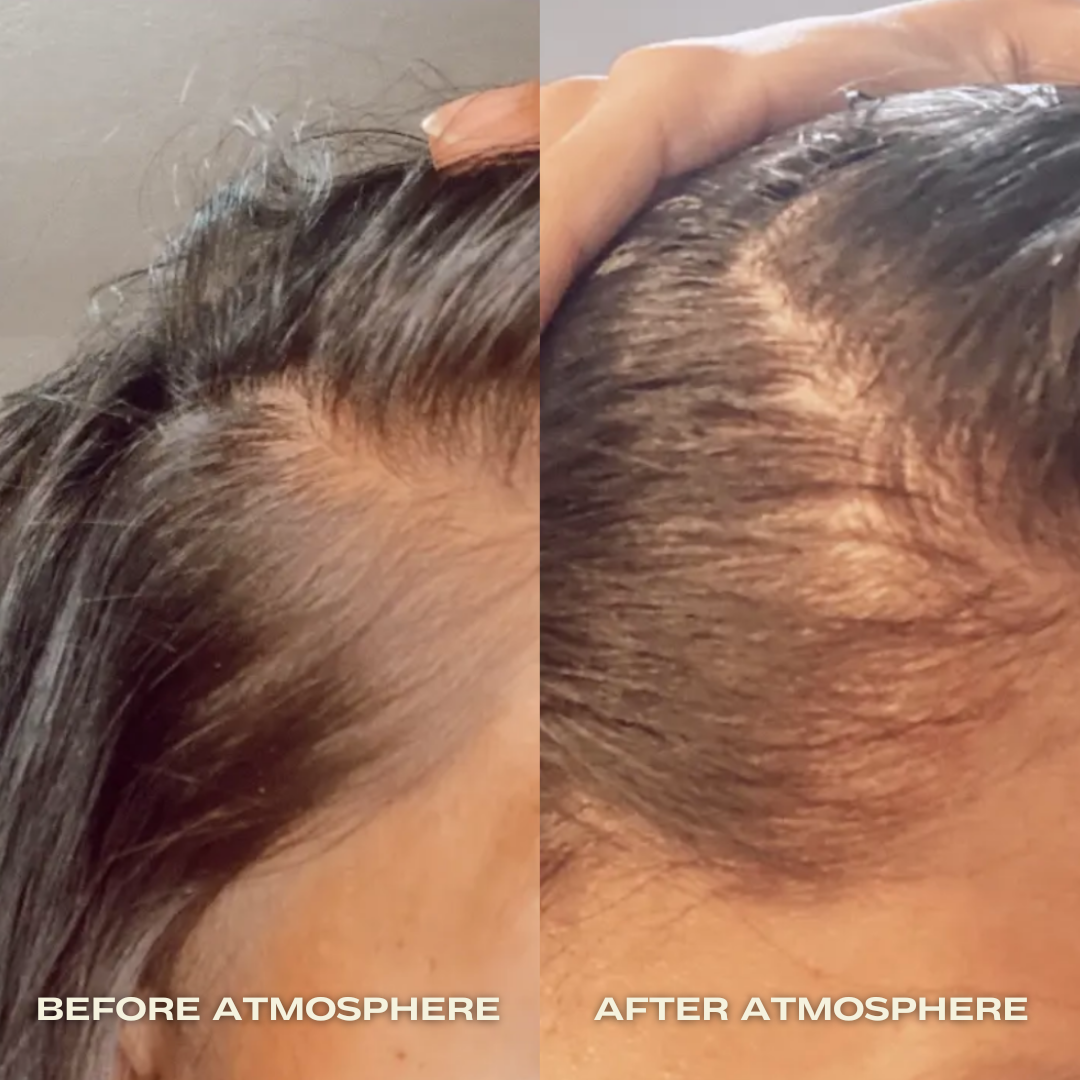 Aphrodite Hair Density Kit