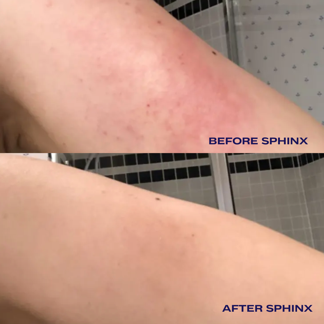 Sphinx Body Experience Oil | For Eczema and Roseacea Relief