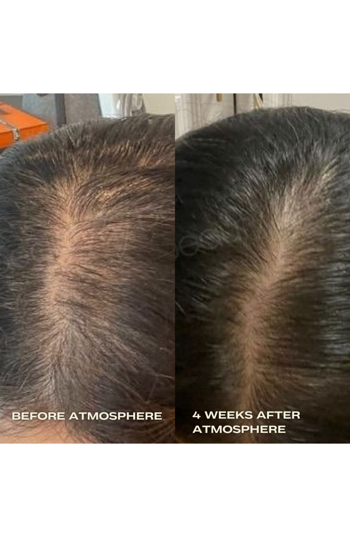 
                  
                    Hair Density & Stress Reset Ritual - Bestsellers Bundle
                  
                