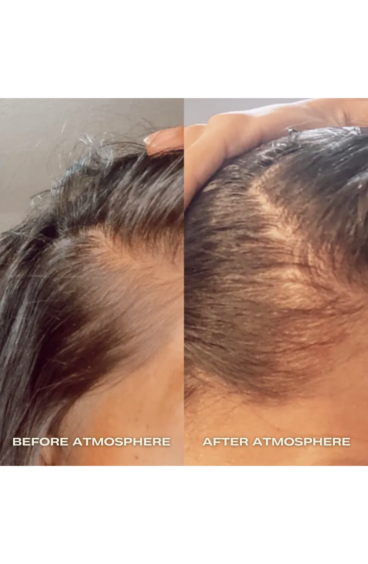 
                  
                    Hair Density & Stress Reset Ritual - Bestsellers Bundle
                  
                