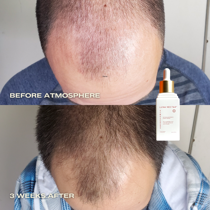 
                  
                    Atmosphere Multi-Peptide Hair Density & Scalp Serum
                  
                