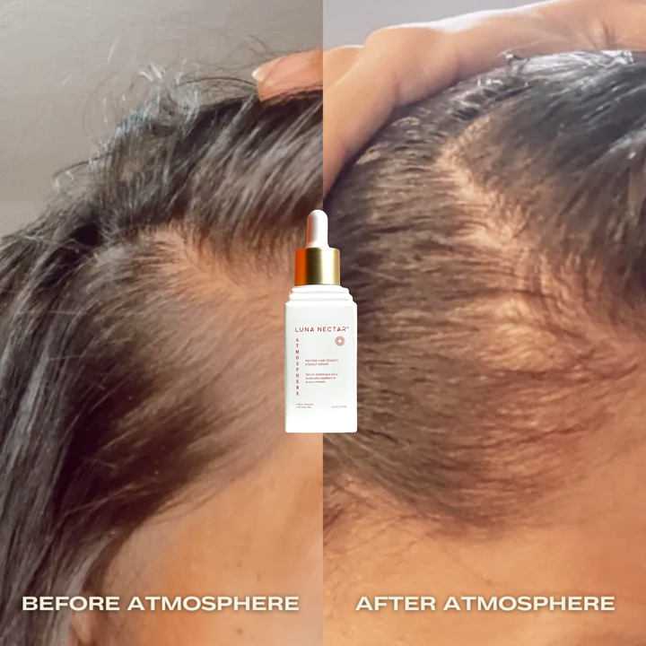 
                  
                    Atmosphere Multi-Peptide Hair Density & Scalp Serum
                  
                