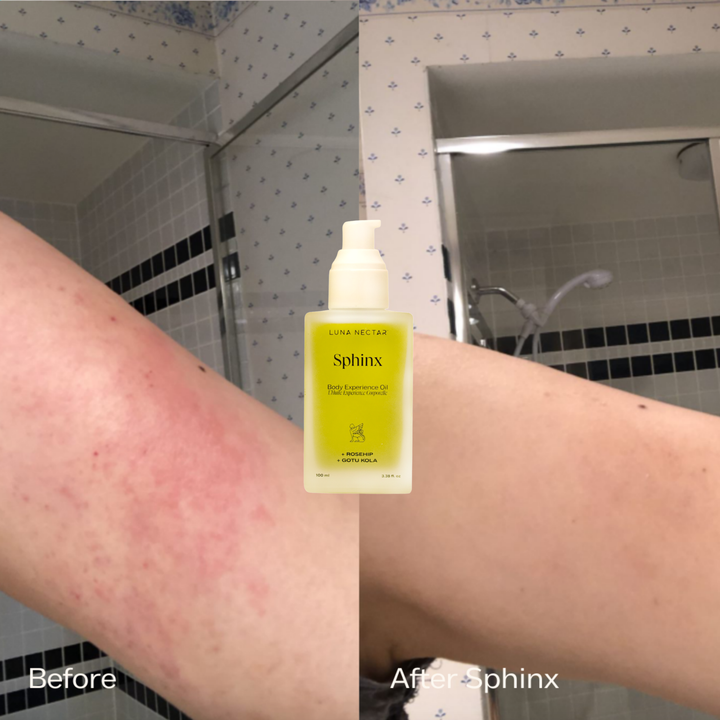 
                  
                    Sphinx Body Experience Oil | For Eczema and Roseacea Relief
                  
                