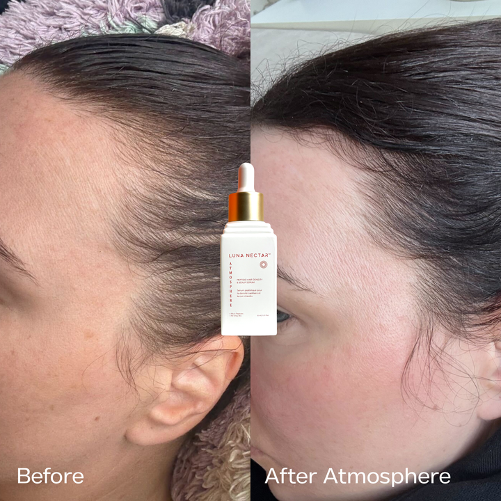 
                  
                    Atmosphere Multi-Peptide Hair Density & Scalp Serum
                  
                