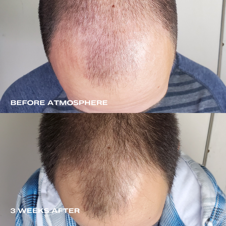 
                  
                    peptide hair density serum everist 
                  
                